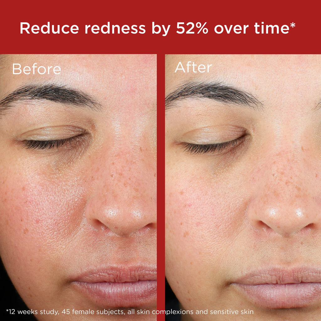 UV Skin Recovery Broad Spectrum SPF 50 Face Sunscreen