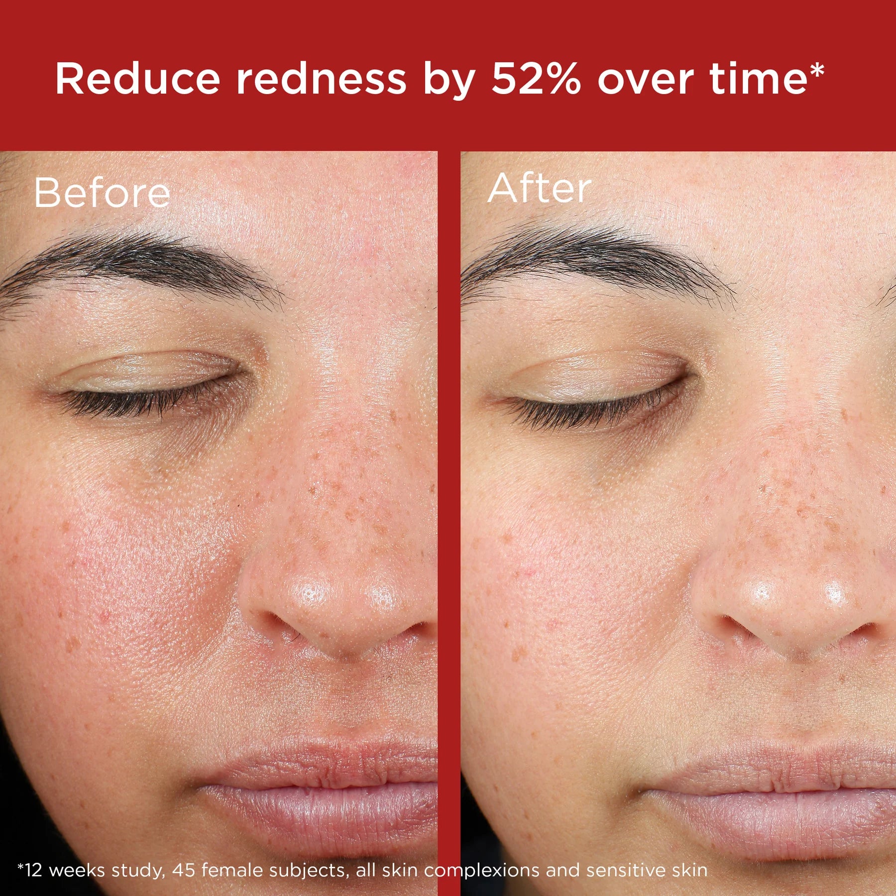 UV Skin Recovery Broad Spectrum SPF 50 Face Sunscreen